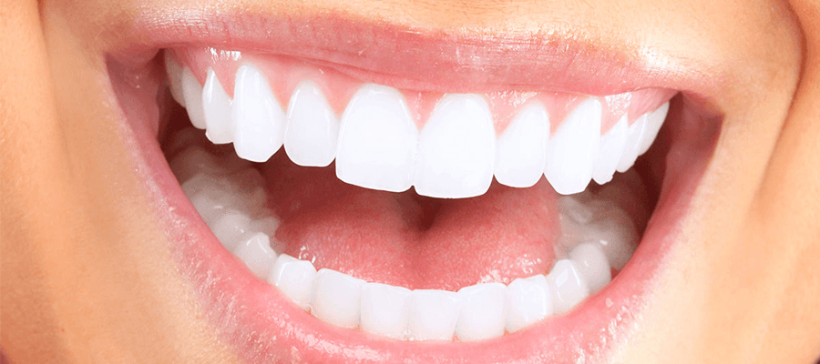 Smile Design (Hollywood Smile)