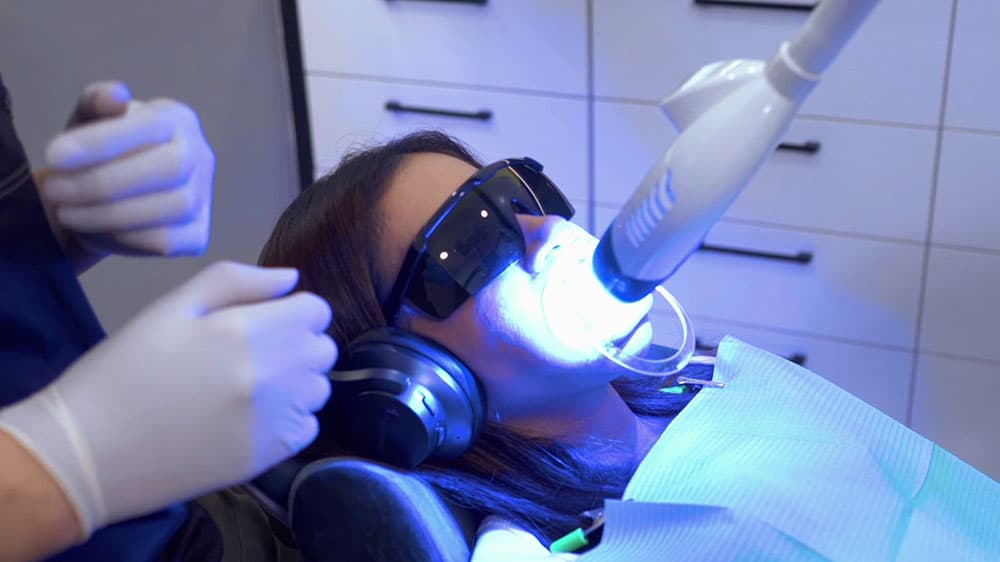 Teeth Whitening