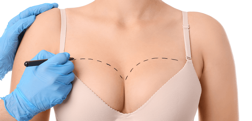 Breast Surgery