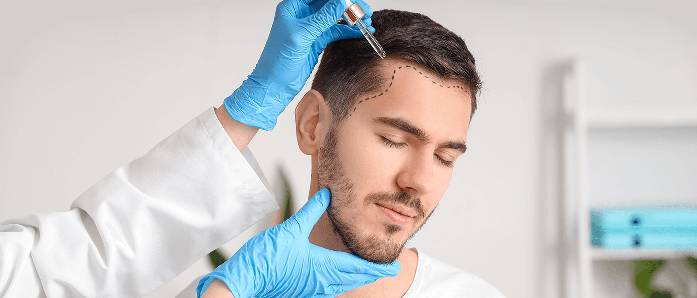 Hair Transplant