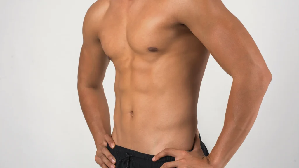 Gynecomastia
