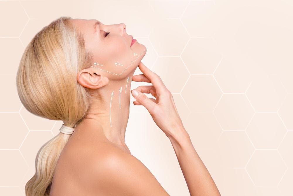 Neck Lift